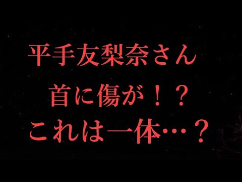 【欅坂46】平手友梨奈さんの首に傷の跡が！？これは一体…？
